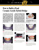 How to Build a Fixed Ceramic-Acrylic Hybrid Bridge