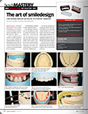 The Art of Smile Design